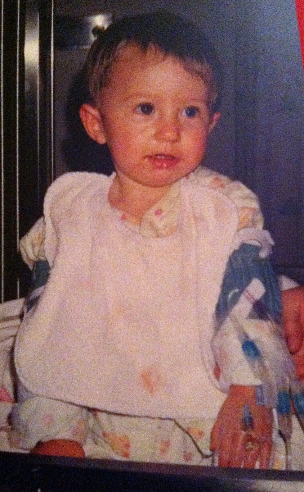 The Challenges Of Having A Cleft Palate