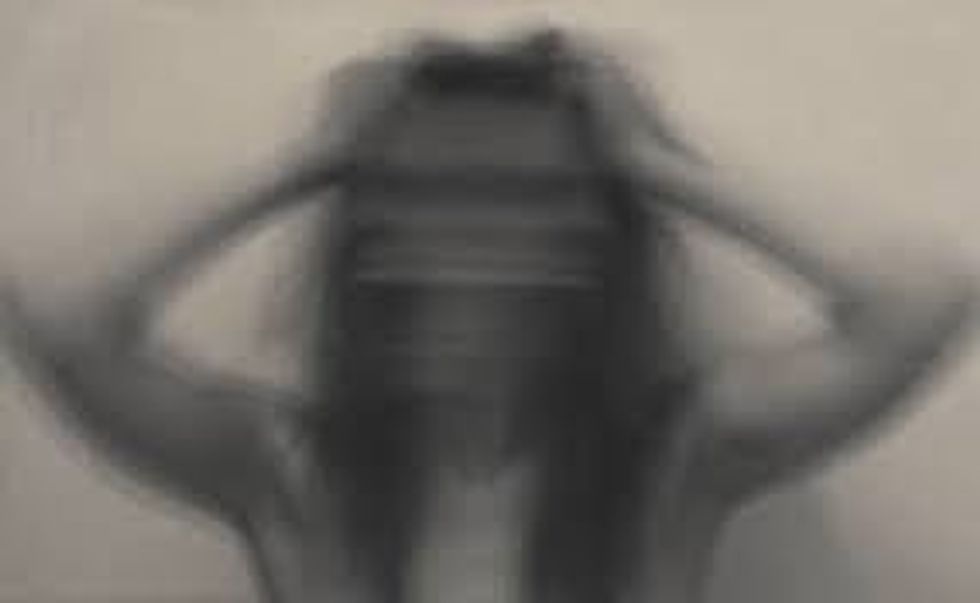 What it's Like Living With Social Anxiety