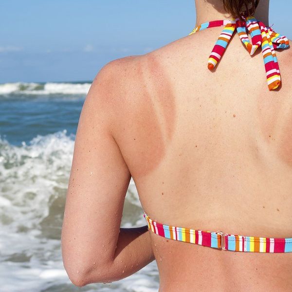Six Struggles Every Pale Person Deals With In The Summer