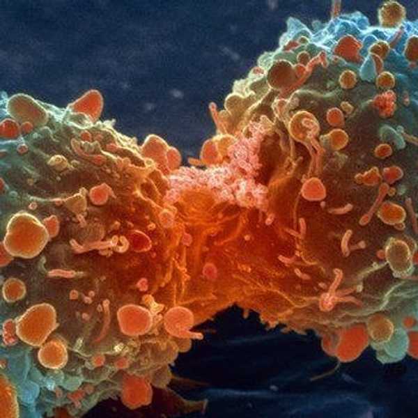 Why There Will Never Be A "Cure For Cancer"