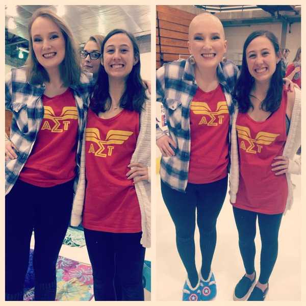 Why I Shaved My Head In Solidarity