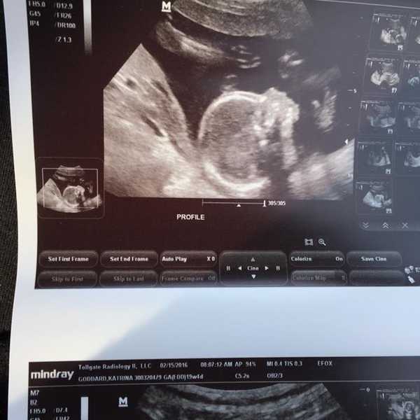 To The Little Girl Who Saved My Life Before She Was Even Born