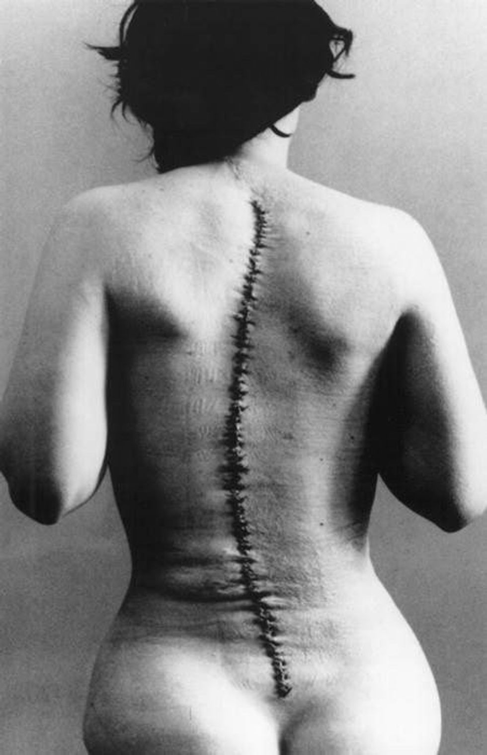 Scar: A New Definition For An Old Mark