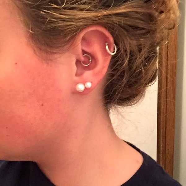 Daith Piercings And Migraines