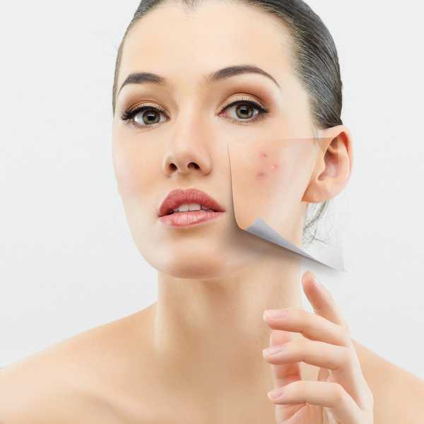 The Skin Clearing Truths No One Told You
