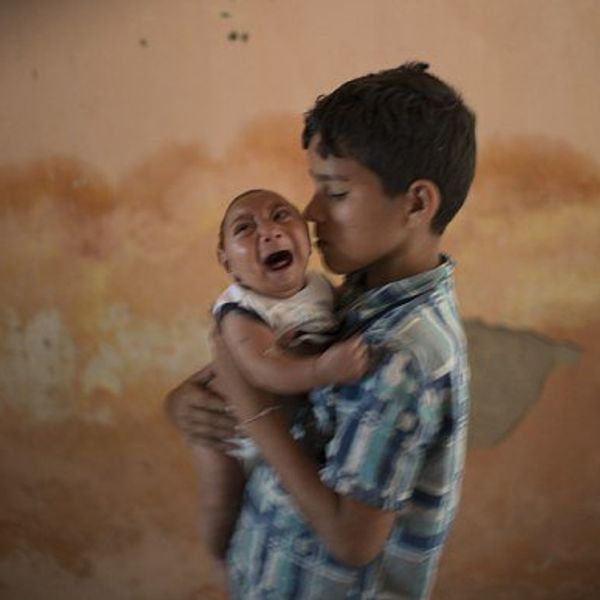 Zika Virus May Not Be To Blame For Birth Defects