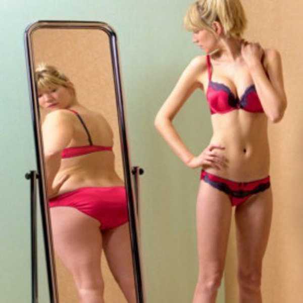 9 Things You Didn't Know About Eating Disorders