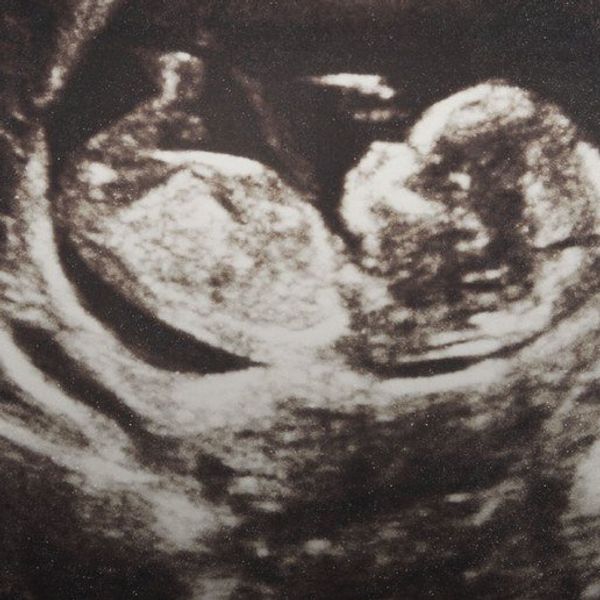 5 Reasons Why I Am Not Pro-Life