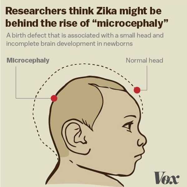 What We Know So Far About The Zika Virus