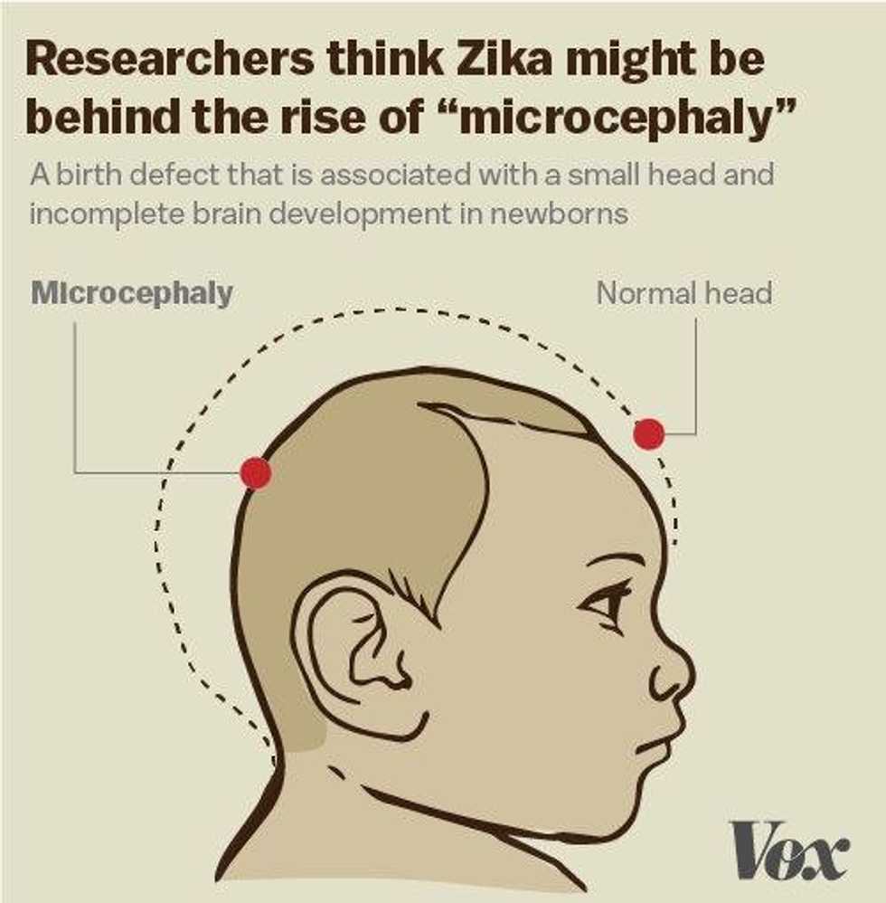 What We Know So Far About The Zika Virus