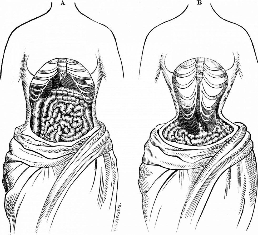 The Ugly Truth Behind Waist Training