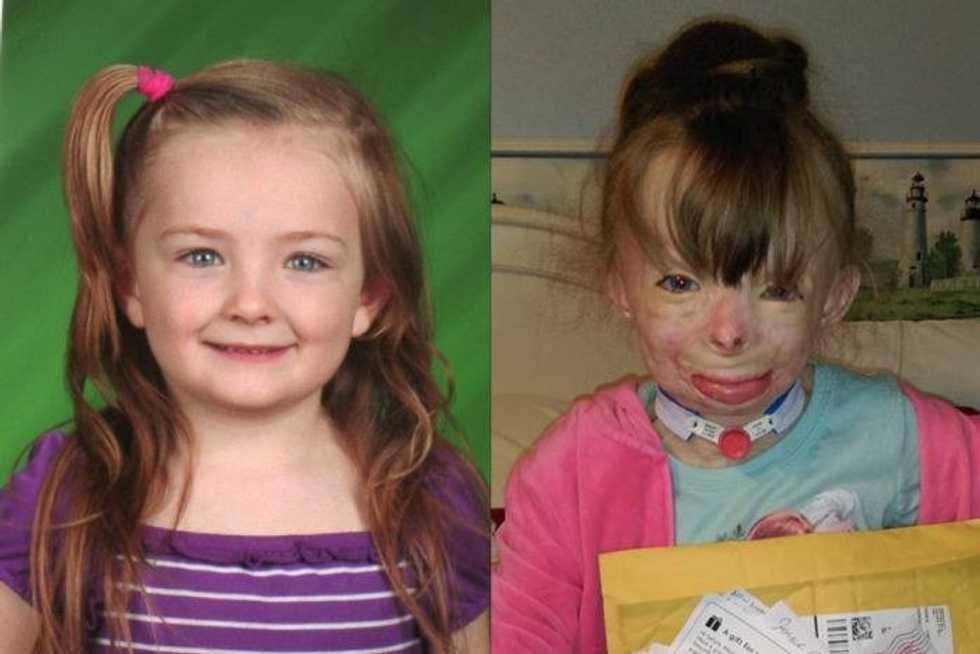 Safyre Terry, Lone Survivor Of Arson, Has One Christmas Wish