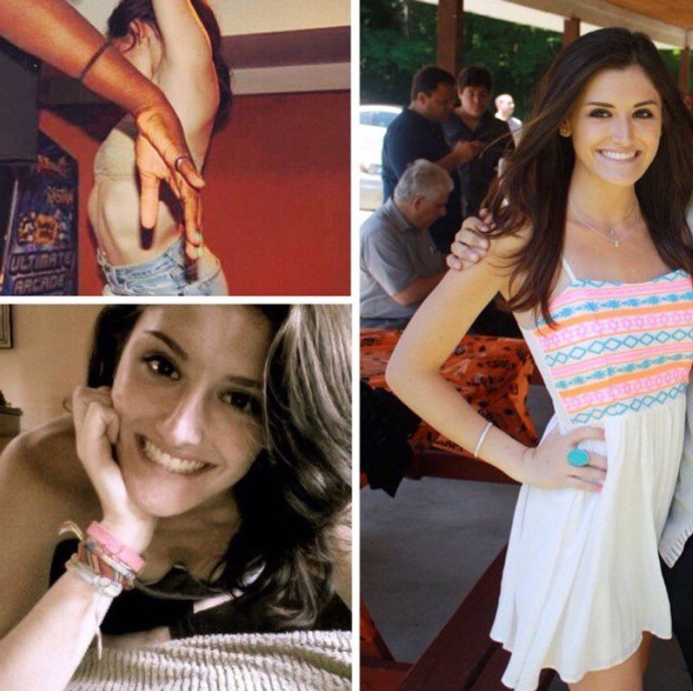 Today I Am .. Not An Eating Disorder