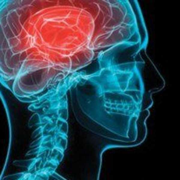 Get Your Head *Out* Of The Game