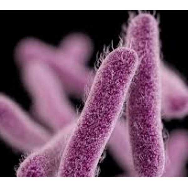 The Shigella Outbreak: What You Need To Know