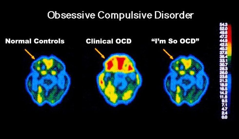 Please Stop Saying "I'm So OCD"