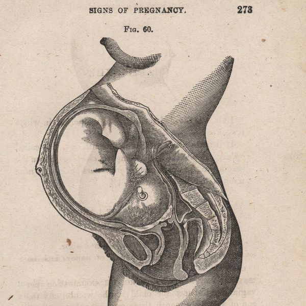 A Response To A Critique On Yale Health's Abortion Policy