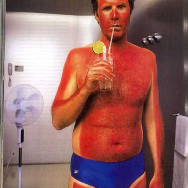 The 5 Stages of Sunburns