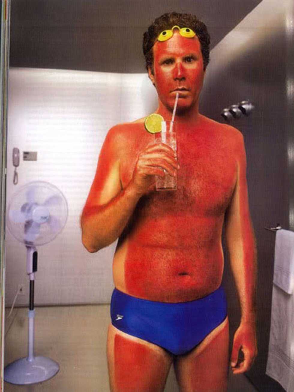 The 5 Stages of Sunburns