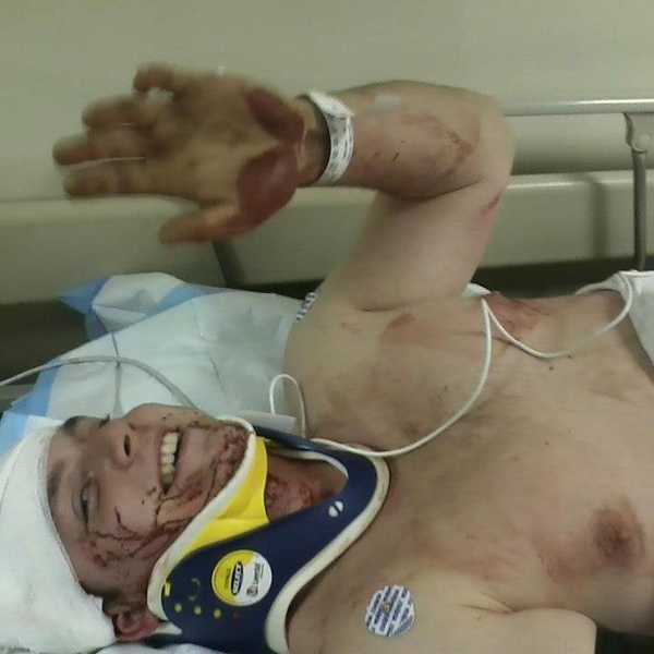 7 Tips On Surviving Life From The Guy Who Almost Didn’t