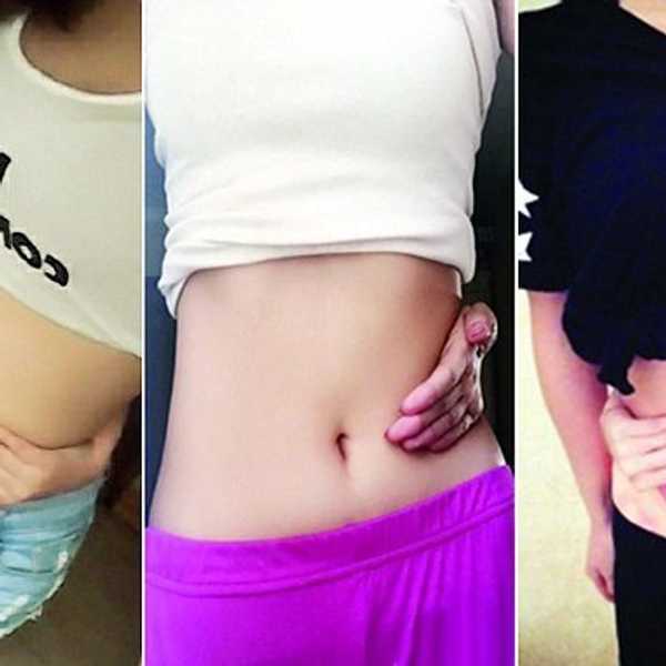 The Viral “Belly Button Challenge” Is the Internet’s
Craziest Body-Shaming Sensation