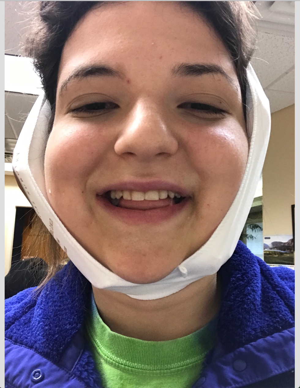 10 Things I Wish I Knew Before My Wisdom Teeth Were Pulled