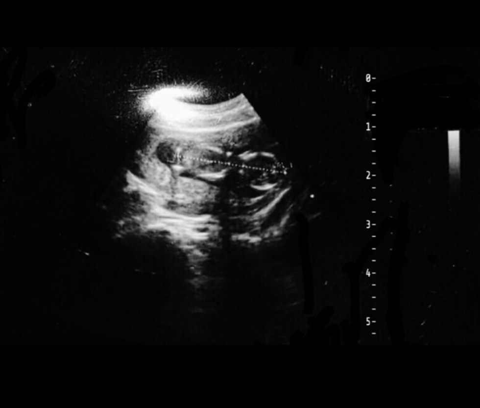 A Letter To The Boy Who Got Me Pregnant