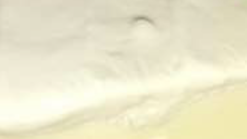 I Love You So Much It Hurts