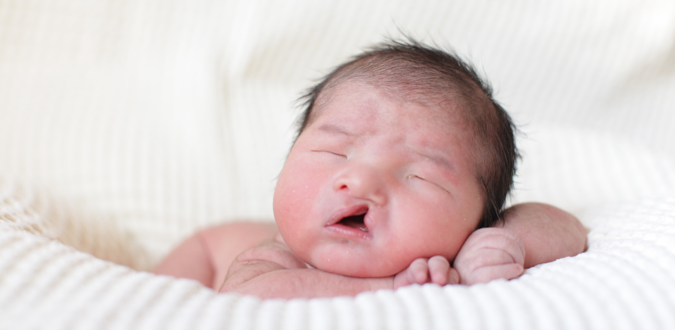 My Story Of Cleft Palate: Part 1