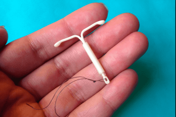 This Is What Happens When Getting The IUD Does Not Turn Out OK