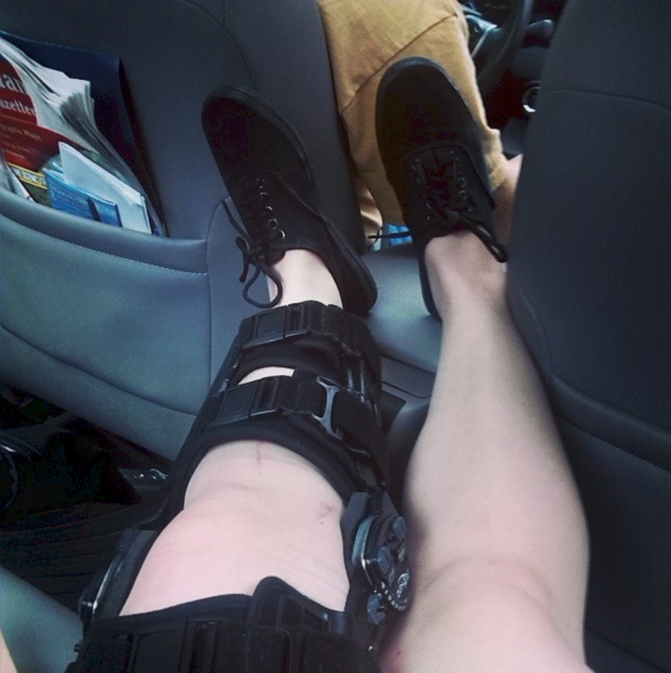 I'm Learning To Accept The Fact That I Need A Fourth Knee Surgery