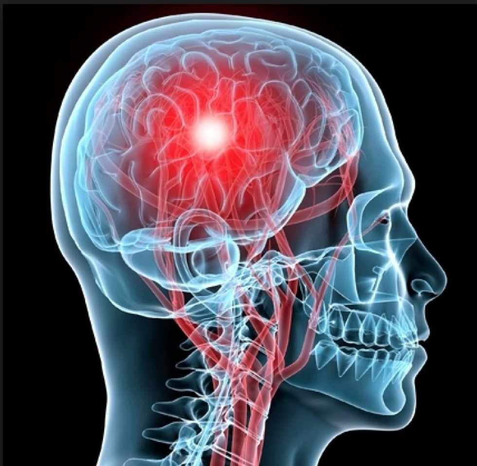 What I Learned From My Concussions