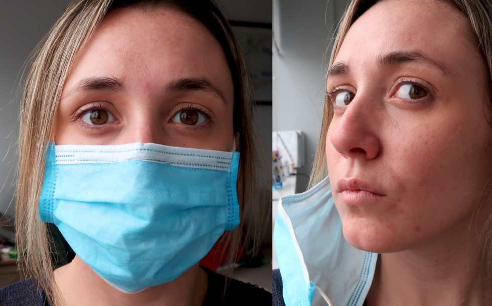 "Avoid Wearing Makeup" And 5 Other Tips For Those Struggling With 'Maskne' During COVID-19