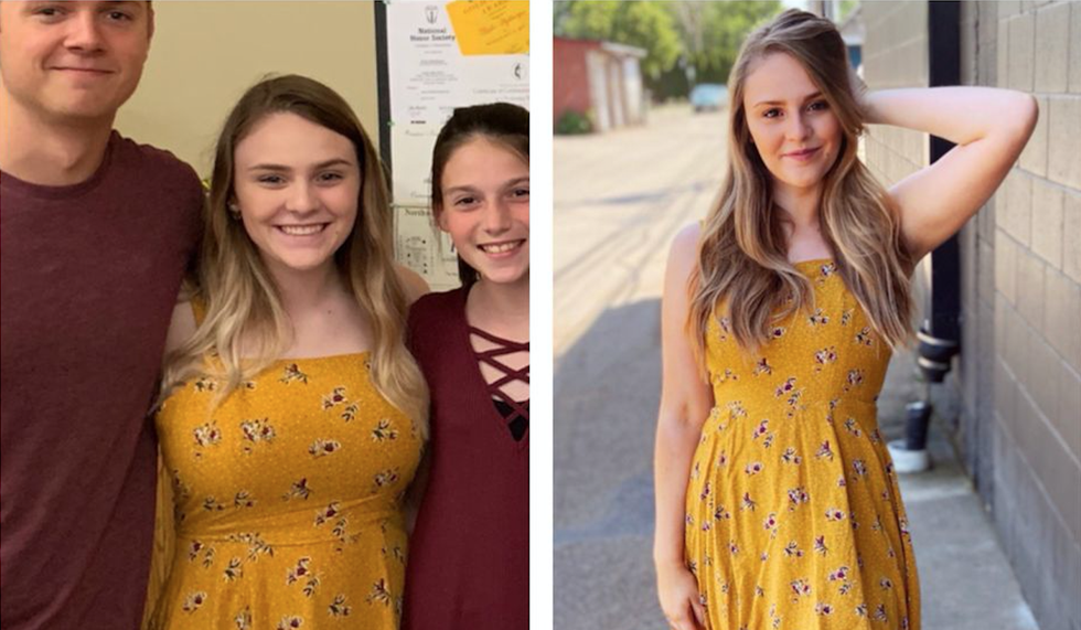 My Story About Breast Reduction Surgery: Tori Pitzer