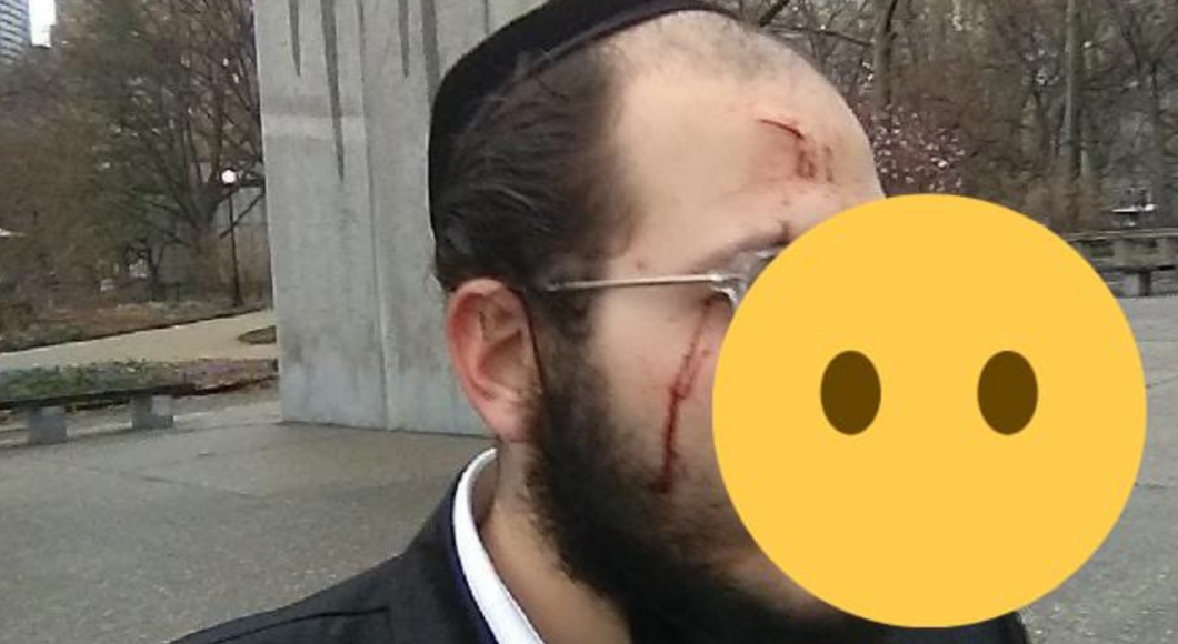 Hate Crimes Against Jewish People Are Largely Ignored And People Must Pay Attention