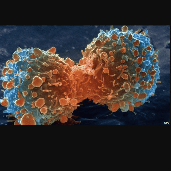 What Exactly Is Cancer?