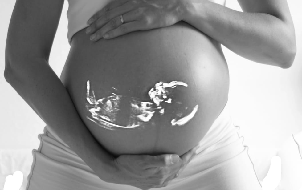 Just Because I'm Pro-Choice Does Not Mean I'm Pro-Abortion