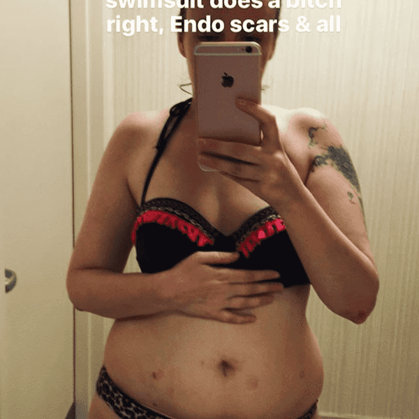 Why I Want Lena Dunham to be My Role Model and Why She Can't Be