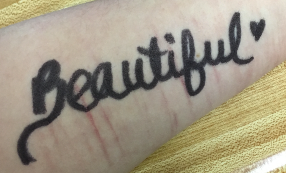 Alessia Cara's "Scars To Your Beautiful"