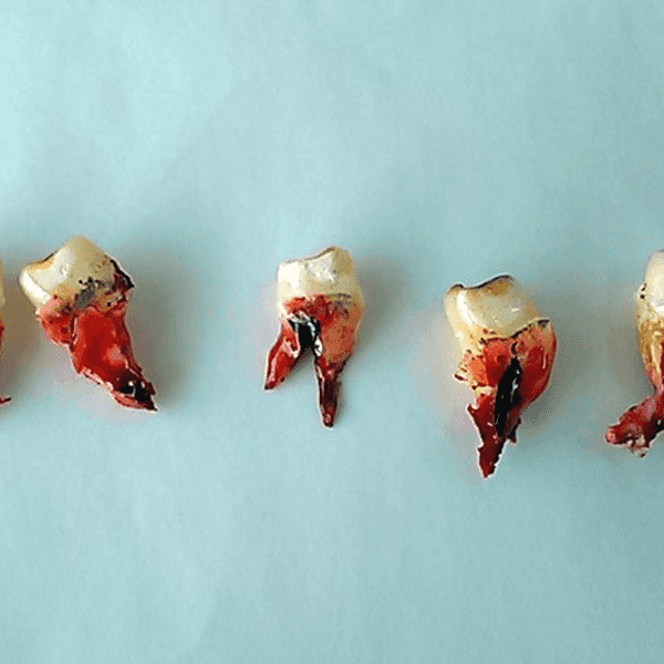 Toothless, A Short Horror Story