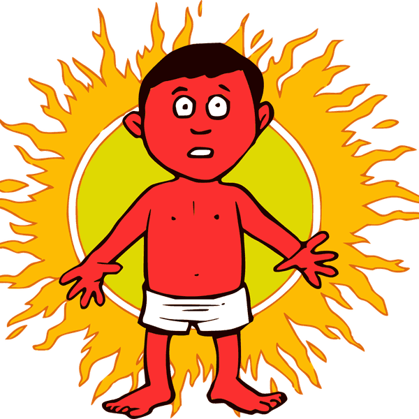 5 Thing People Who Sunburn Easily Know