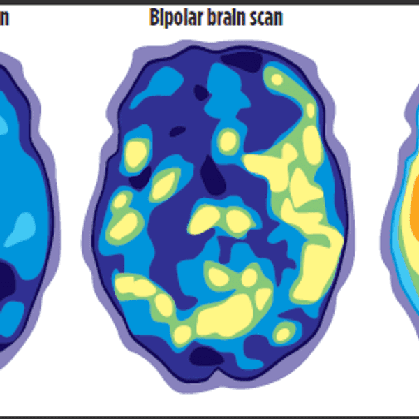 Stop Changing the Meaning of Mental Illness