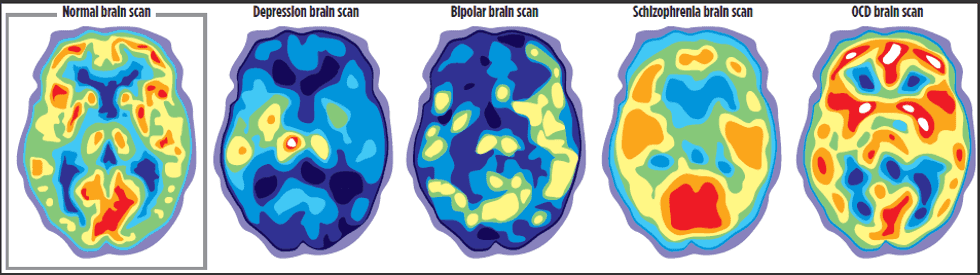 Stop Changing the Meaning of Mental Illness