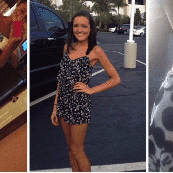 Recovering From Eating Disorders Isn't Always Easy