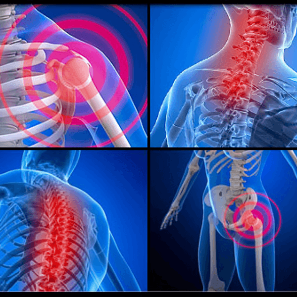 Fighting With Fibromyalsia: Scotty Ireson's Story