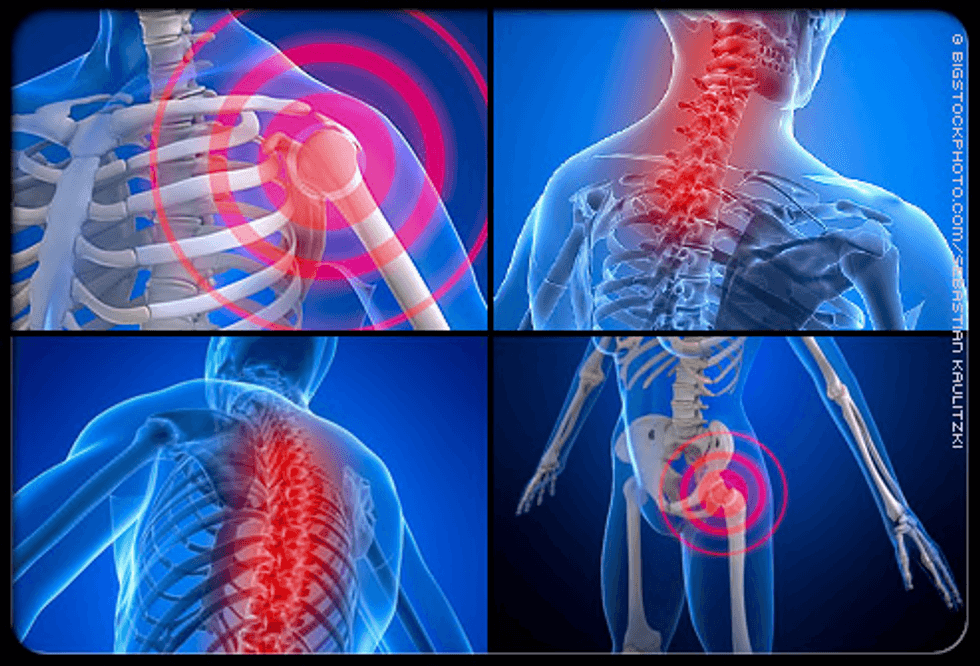 Fighting With Fibromyalsia: Scotty Ireson's Story