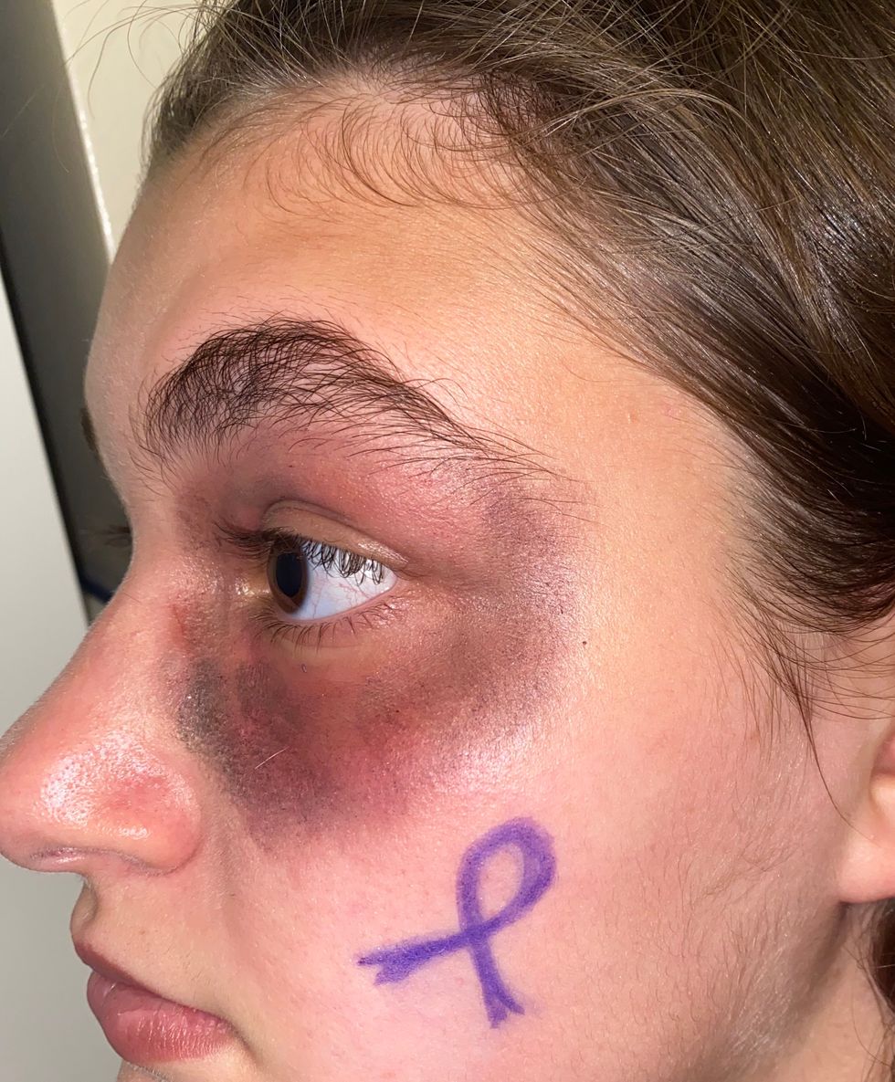 Warning Signs That Someone Is Experiencing Domestic Abuse