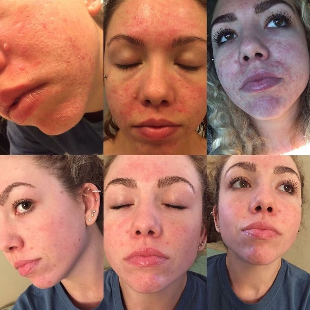 scontent-iad3-1.cdninstagram.com